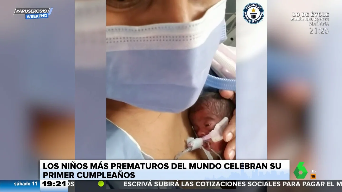 Los niños más prematuros del mundo celebran su primer cumpleaños Los niños más prematuros del mundo celebran su primer cumpleaños