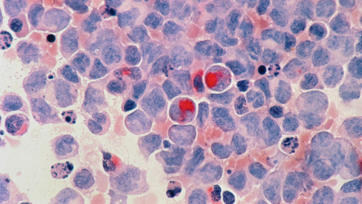 NXCP900, el f&aacute;rmaco de un doctor espa&ntilde;ol que ha vencido en ratones, a diferentes tipo de c&aacute;ncer