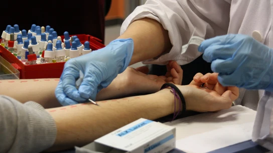 Así será la primavera para los alérgicos en España, según las previsiones de los alergólogos Así será la primavera para los alérgicos en España, según las previsiones de los alergólogos