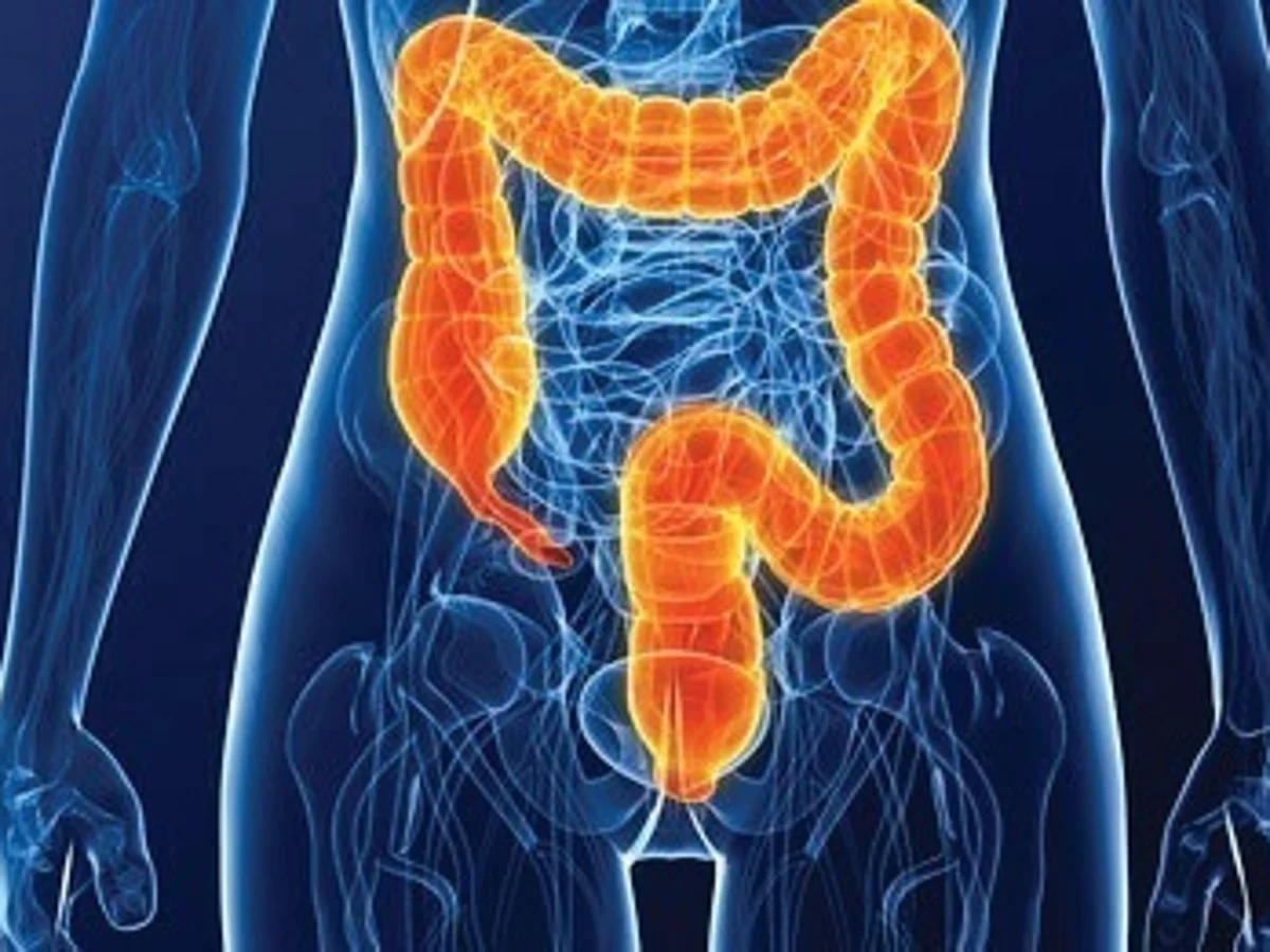 Estos son los síntomas del cáncer de colon por los que deberías consultar  siempre con un médico