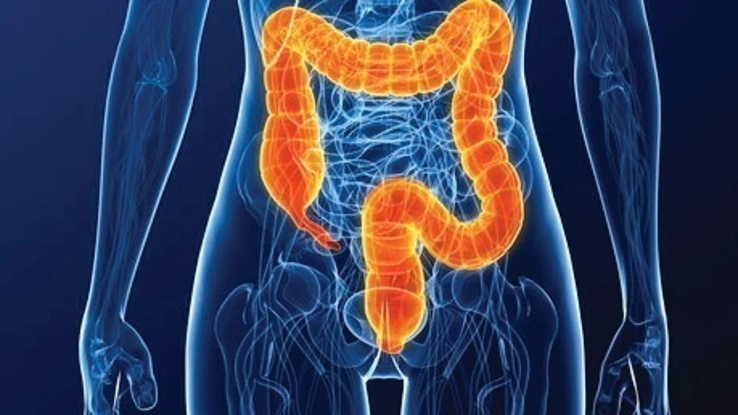 Imagen de archivo. Estos son los síntomas del cáncer de colon por los que deberías consultar siempre con un médico