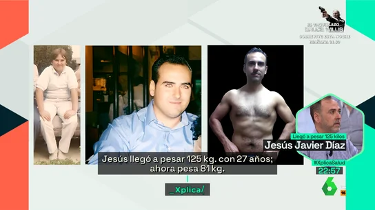 "Si un niño pasa la pubertad siendo obeso, lo va a ser toda su vida": la explicación científica detrás de esta enfermedad "Si un niño pasa la pubertad siendo obeso, lo va a ser toda su vida": la explicación científica detrás de esta enfermedad