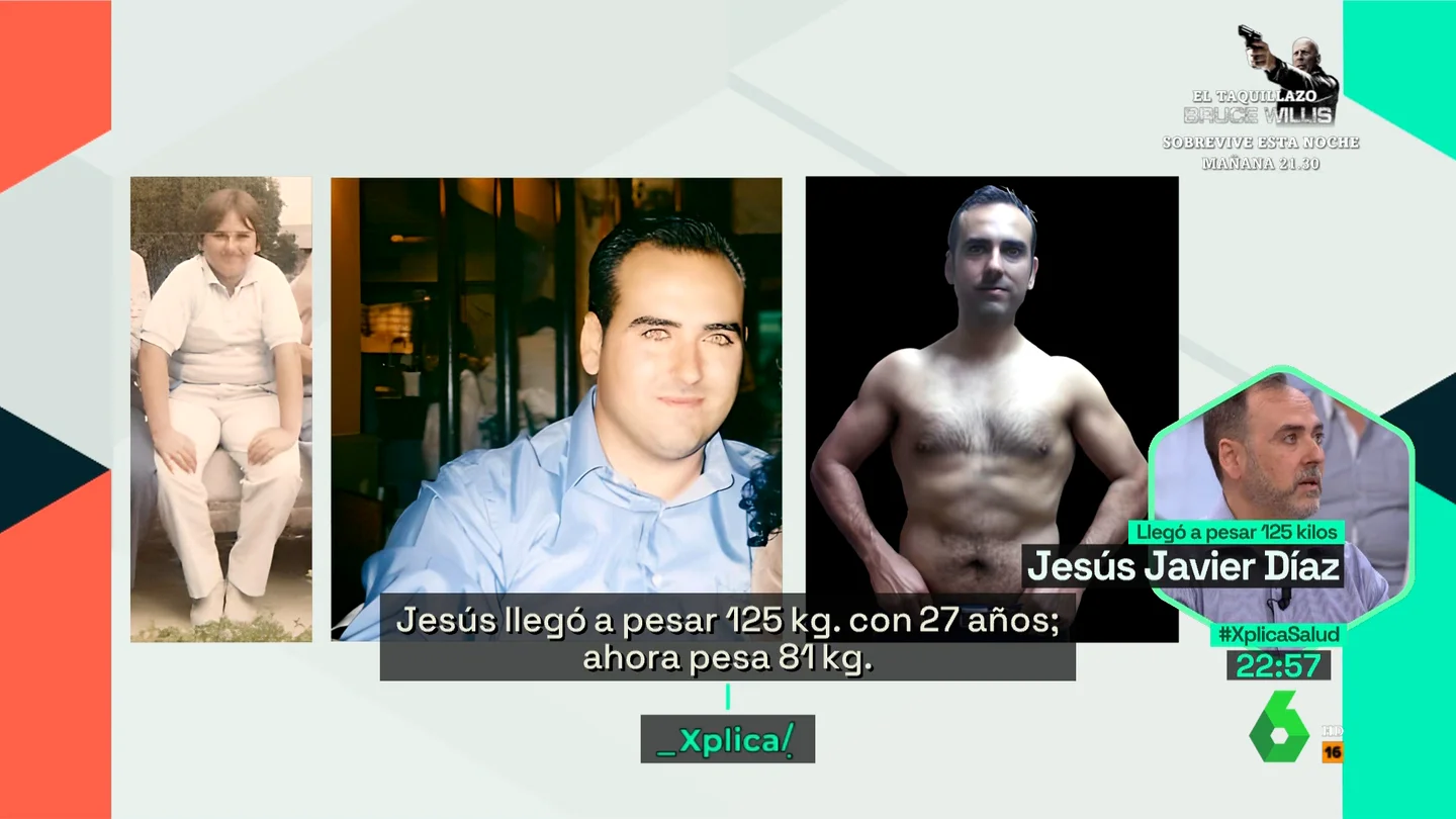 "Si un niño pasa la pubertad siendo obeso, lo va a ser toda su vida": la explicación científica detrás de esta enfermedad "Si un niño pasa la pubertad siendo obeso, lo va a ser toda su vida": la explicación científica detrás de esta enfermedad