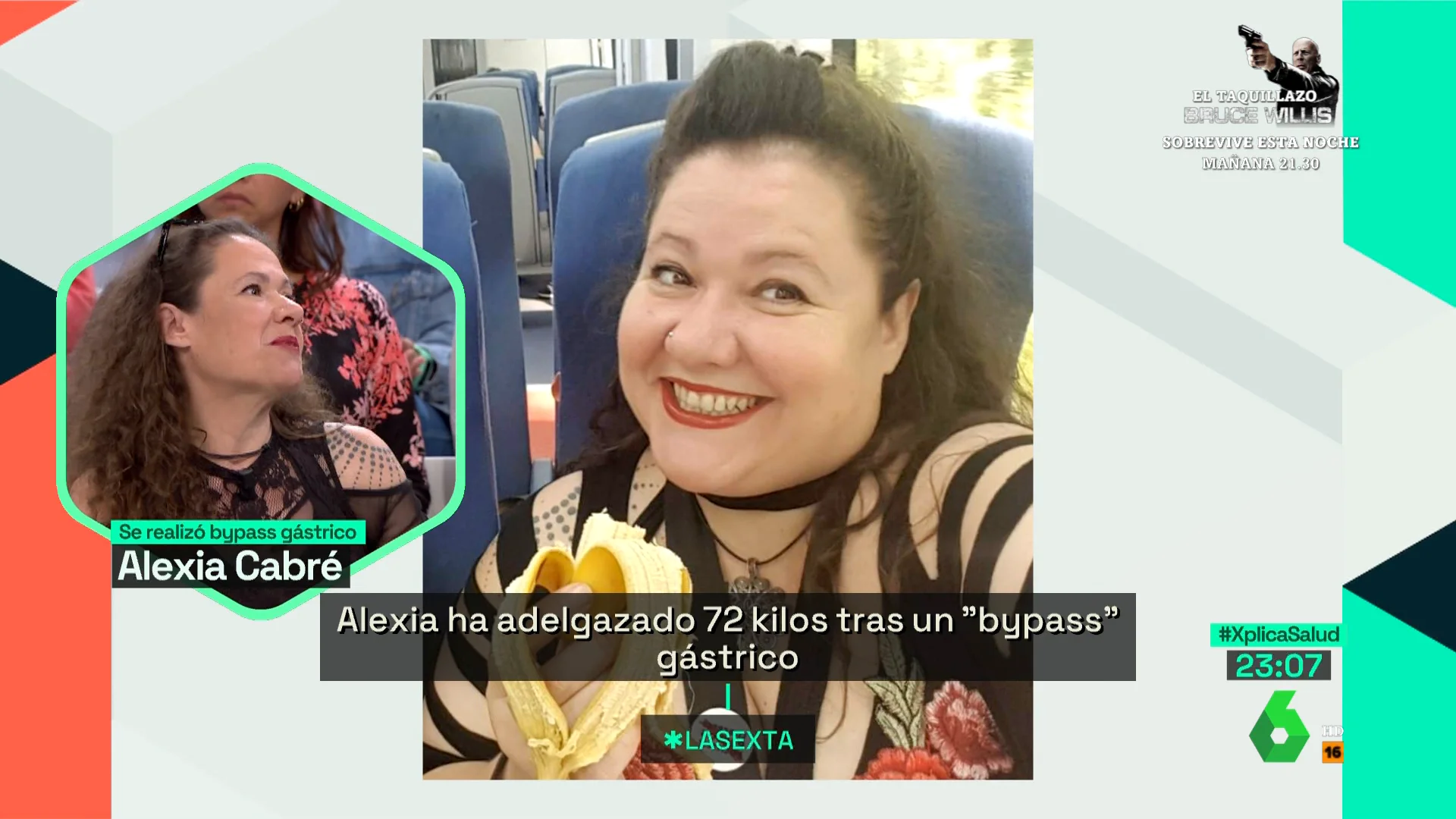 Alexia, tras adelgazar 72 kilos con un bypass gástrico: "Voy a ser obesa crónica de por vida"