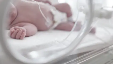 Un recién nacido en una incubadora Un recién nacido en una incubadora