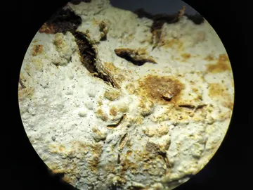 Gloeocystidiellum lojanense vista desde el microscopio Gloeocystidiellum lojanense vista desde el microscopio