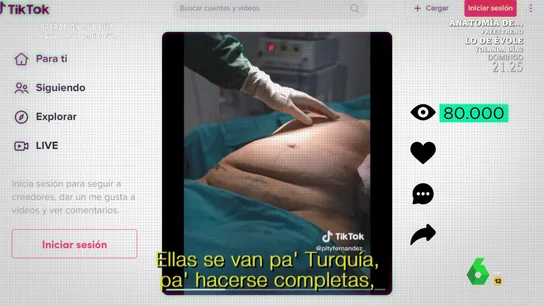 Los riesgos de la cirugía en Turquía que utiliza TikTok como reclamo Los riesgos de la cirugía en Turquía que utiliza TikTok como reclamo