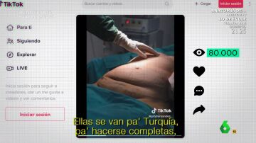 Los riesgos de la cirugía en Turquía que utiliza TikTok como reclamo