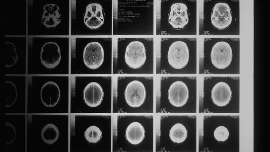 Imagen de archivo de varios escáneres del cerebro. Imagen de archivo de varios escáneres del cerebro.
