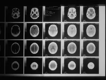 Imagen de archivo de varios escáneres del cerebro.
