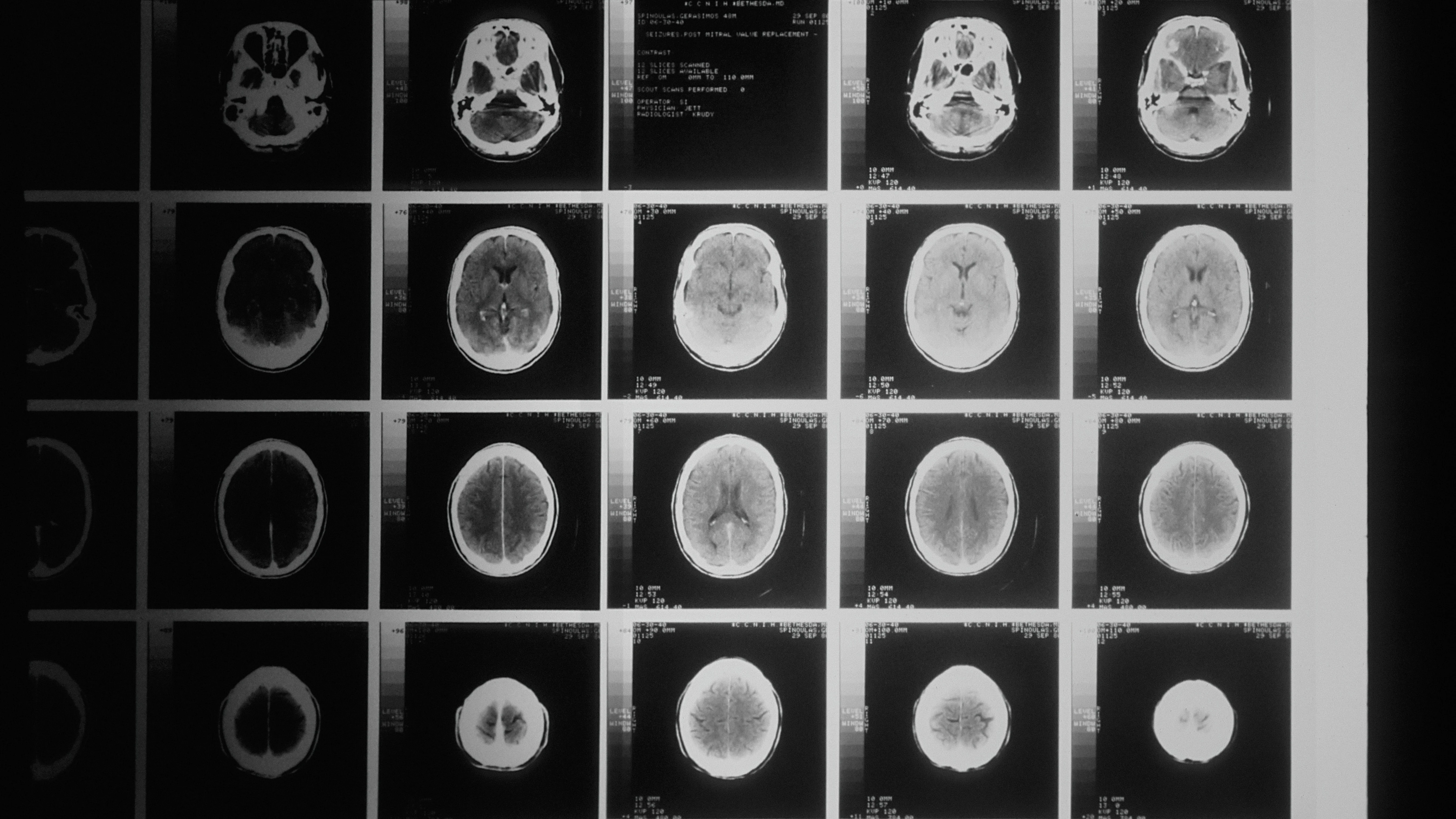 Imagen de archivo de varios escáneres del cerebro.