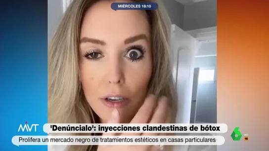 Parálisis facial, labios destrozados... las impactantes imágenes de inyecciones de botox 'clandestinas' Parálisis facial, labios destrozados... las impactantes imágenes de inyecciones de botox 'clandestinas'