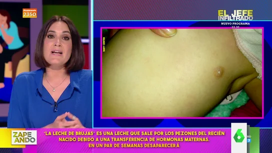 ¿Qué es la leche de brujas? Boticaria García explica qué hacer cuando al bebé le sale leche por los pezones  ¿Qué es la leche de brujas? Boticaria García explica qué hacer cuando al bebé le sale leche por los pezones