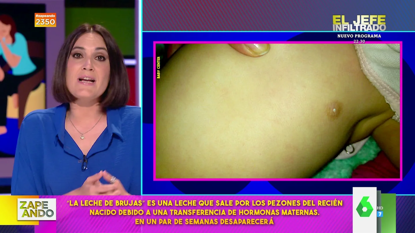 ¿Qué es la leche de brujas? Boticaria García explica qué hacer cuando al bebé le sale leche por los pezones ¿Qué es la leche de brujas? Boticaria García explica qué hacer cuando al bebé le sale leche por los pezones