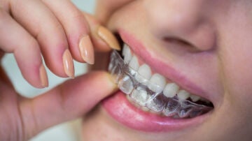 Los ortodoncistas alertan del riesgo de comprar alineadores invisibles por internet