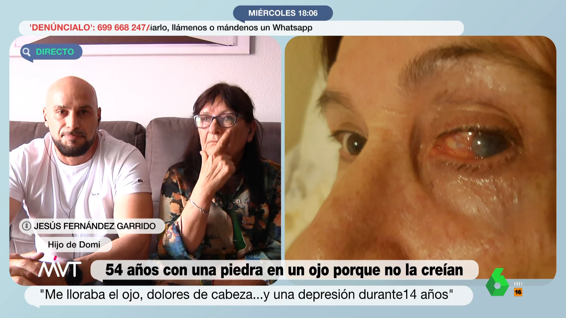 La emoción de Domi al recordar sus 54 años con una piedra en el ojo: "Estaba hecha polvo"