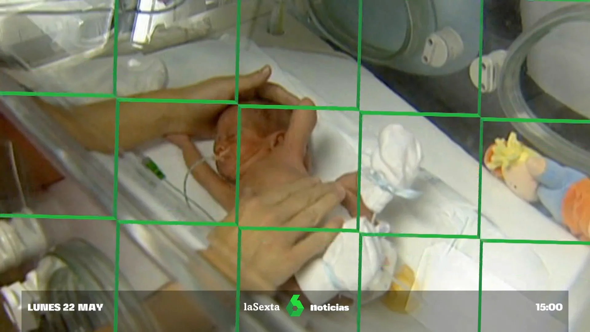cordon umbilical