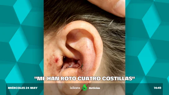 "Gritaron 'bolleras de mierda' y nos empezaron a golpear", denuncian esta agresión a dos mujeres en el Parque Warner "Gritaron 'bolleras de mierda' y nos empezaron a golpear", denuncian esta agresión a dos mujeres en el Parque Warner