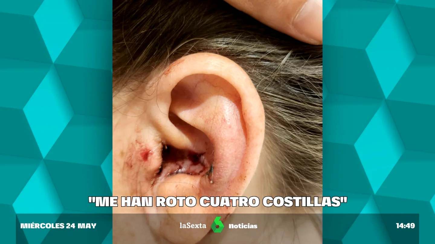"Gritaron 'bolleras de mierda' y nos empezaron a golpear", denuncian esta agresión a dos mujeres en el Parque Warner "Gritaron 'bolleras de mierda' y nos empezaron a golpear", denuncian esta agresión a dos mujeres en el Parque Warner
