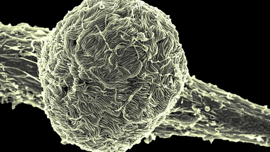 Cómo se transmite el ébola Cómo se transmite el ébola