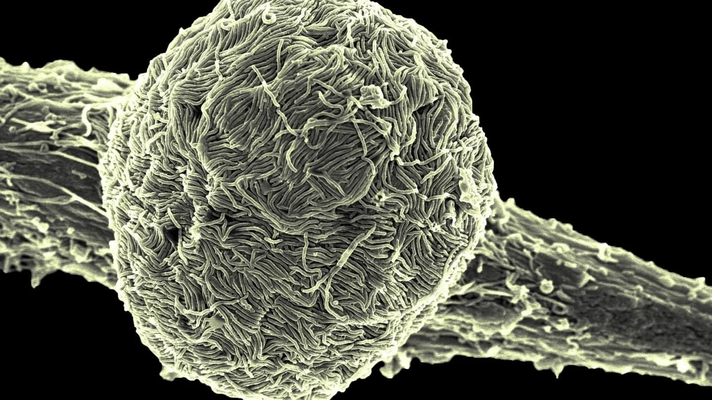Cómo se transmite el ébola Cómo se transmite el ébola