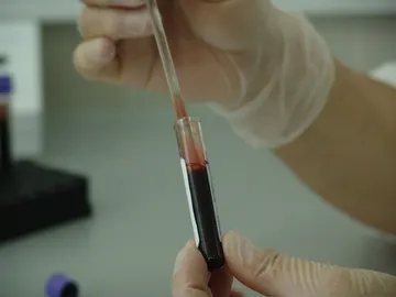 Prueba de sangre Prueba de sangre