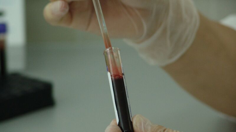 Bloquean una proteína para mejorar los resultados de la radioterapia