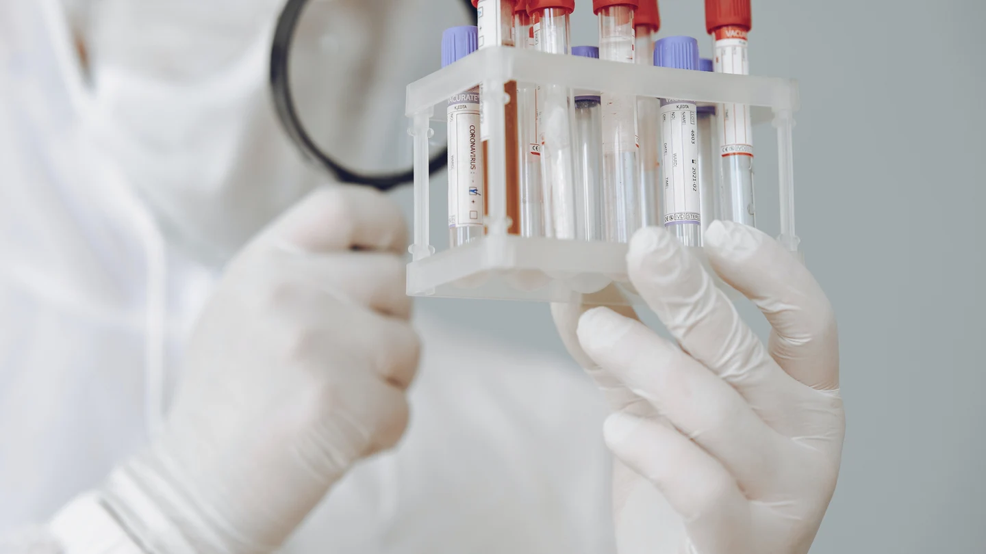 Analizan la existencia de plomo en la sangre de niños y embarazadas por la cercanía de una fábrica de reciclaje Analizan la existencia de plomo en la sangre de niños y embarazadas por la cercanía de una fábrica de reciclaje