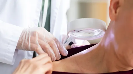 Así son las señales del cáncer de piel no melanoma: cada año se diagnostican en España 74.000 casos Así son las señales del cáncer de piel no melanoma: cada año se diagnostican en España 74.000 casos