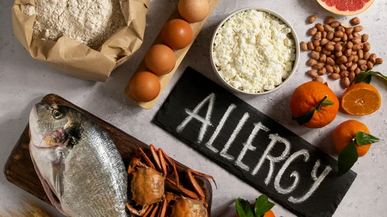 Estas son las diferencias entre alergia e intolerancia alimentaria y los trucos para detectarlas  Estas son las diferencias entre alergia e intolerancia alimentaria y los trucos para detectarlas
