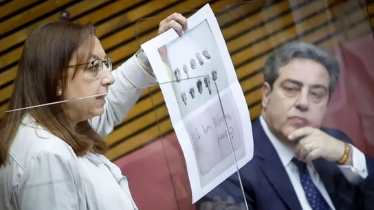 Llanos Massó muestra la imagen de los tipos de pene Llanos Massó muestra la imagen de los tipos de pene