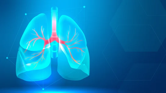 Científicos españoles 'inventan' una innovadora forma de tratar el cáncer de pulmón que eleva la supervivencia un 20% Científicos españoles 'inventan' una innovadora forma de tratar el cáncer de pulmón que eleva la supervivencia un 20%