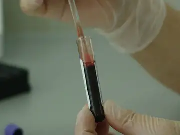 Demuestran la eficacia de una nueva inmunoterapia frente al mieloma multiple resistente Demuestran la eficacia de una nueva inmunoterapia frente al mieloma multiple resistente