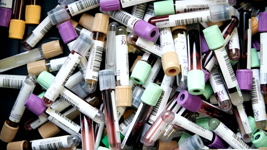 Qué tipos de sangre existen, qué compatibilidades hay y cómo saber cuál tenemos Qué tipos de sangre existen, qué compatibilidades hay y cómo saber cuál tenemos