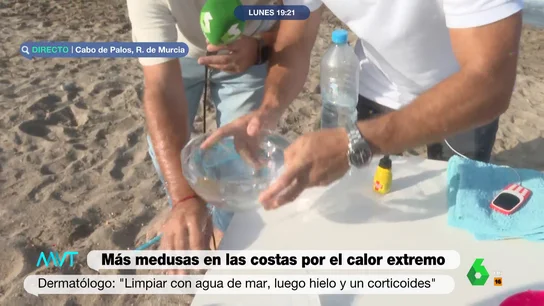 El momento en el que una medusa cae en el brazo de un reportero de Más Vale Tarde: "¡Cuidado!" El momento en el que una medusa cae en el brazo de un reportero de Más Vale Tarde: "¡Cuidado!"