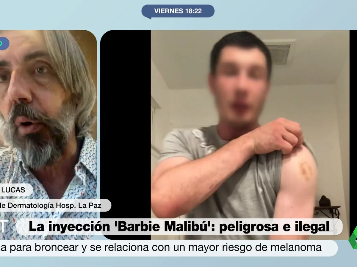 La advertencia de un dermatlogo sobre el bronceador 'Barbie Malib': "Es una droga ilegal sin ninguna indicacin en medicina" La advertencia de un dermatlogo sobre el bronceador 'Barbie Malib': "Es una droga ilegal sin ninguna indicacin en medicina"