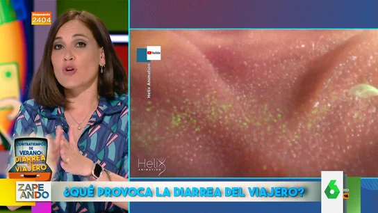 ¿Qué es la diarrea del viajero? Boticaria García explica qué la provoca y cuáles son sus síntomas  ¿Qué es la diarrea del viajero? Boticaria García explica qué la provoca y cuáles son sus síntomas