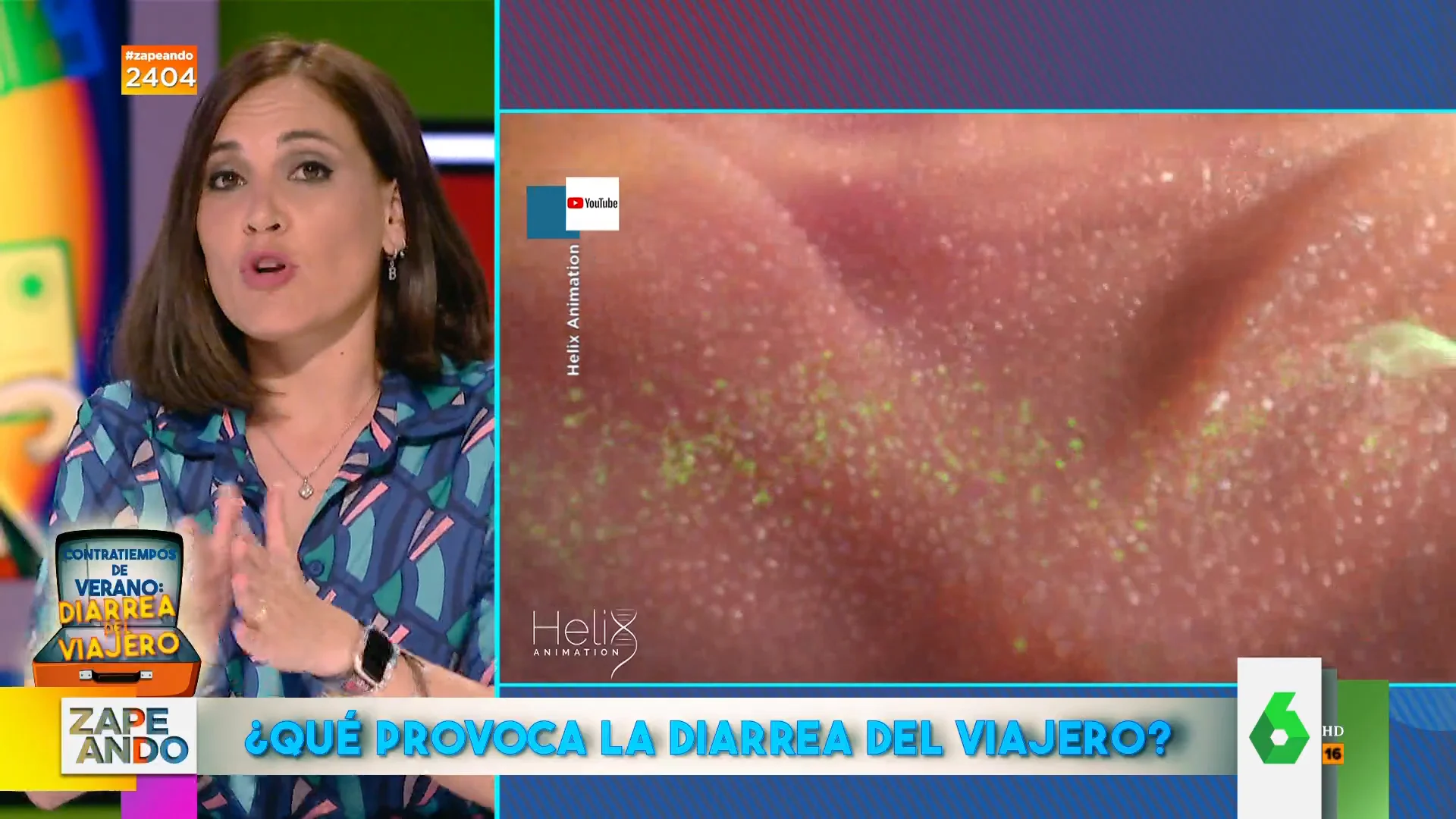 ¿Qué es la diarrea del viajero? Boticaria García explica qué la provoca y cuáles son sus síntomas 