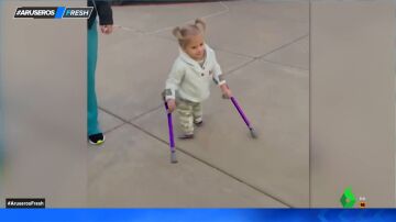 La historia de superación de una niña que nació con 'síndrome de sirena' y consigue caminar con 5 años