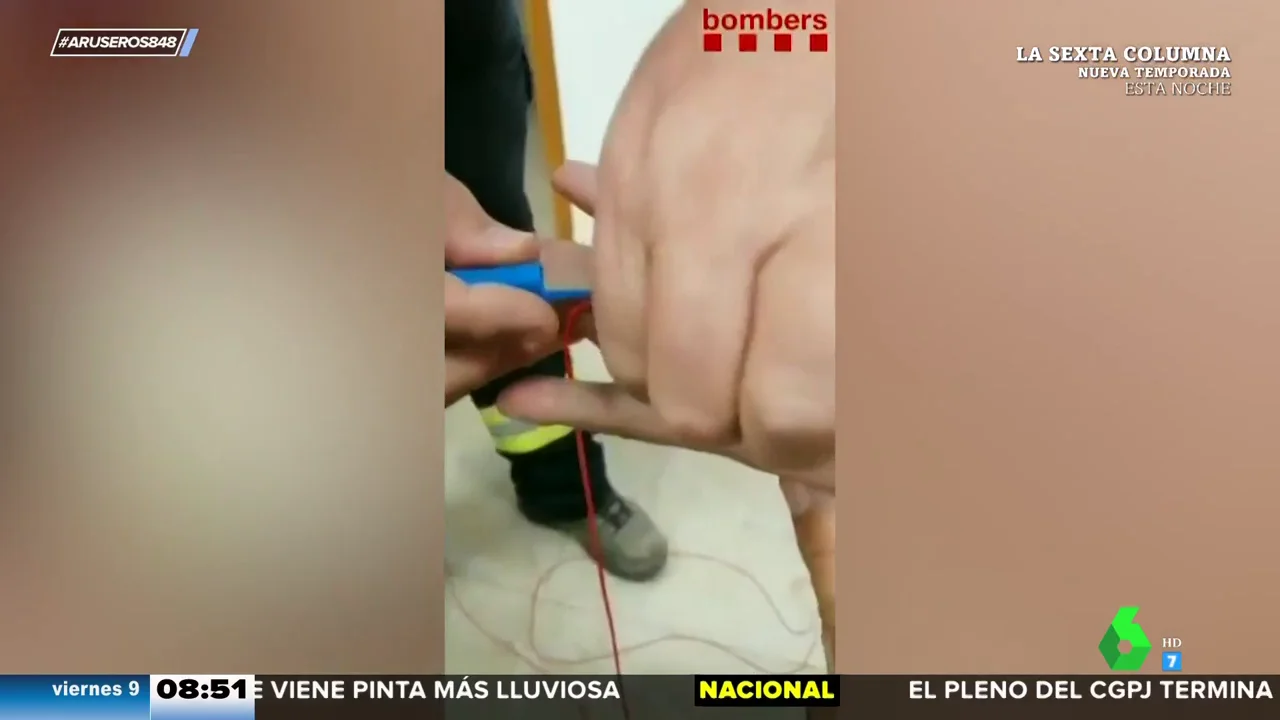 El truco de los bomberos para aprender a quitar un anillo atascado en el dedo: tan solo necesitas un hilo