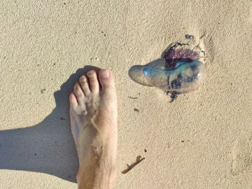 Medusa en una playa junto a los bañistas