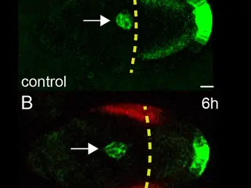 Hallan otro papel de la membrana basal en los órganos que ayudaría al estudio del cáncer Hallan otro papel de la membrana basal en los órganos que ayudaría al estudio del cáncer