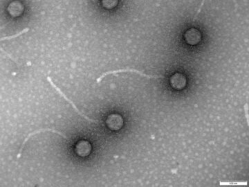 Fagos, los virus "come" bacterias para combatir la resistencia a los antibióticos