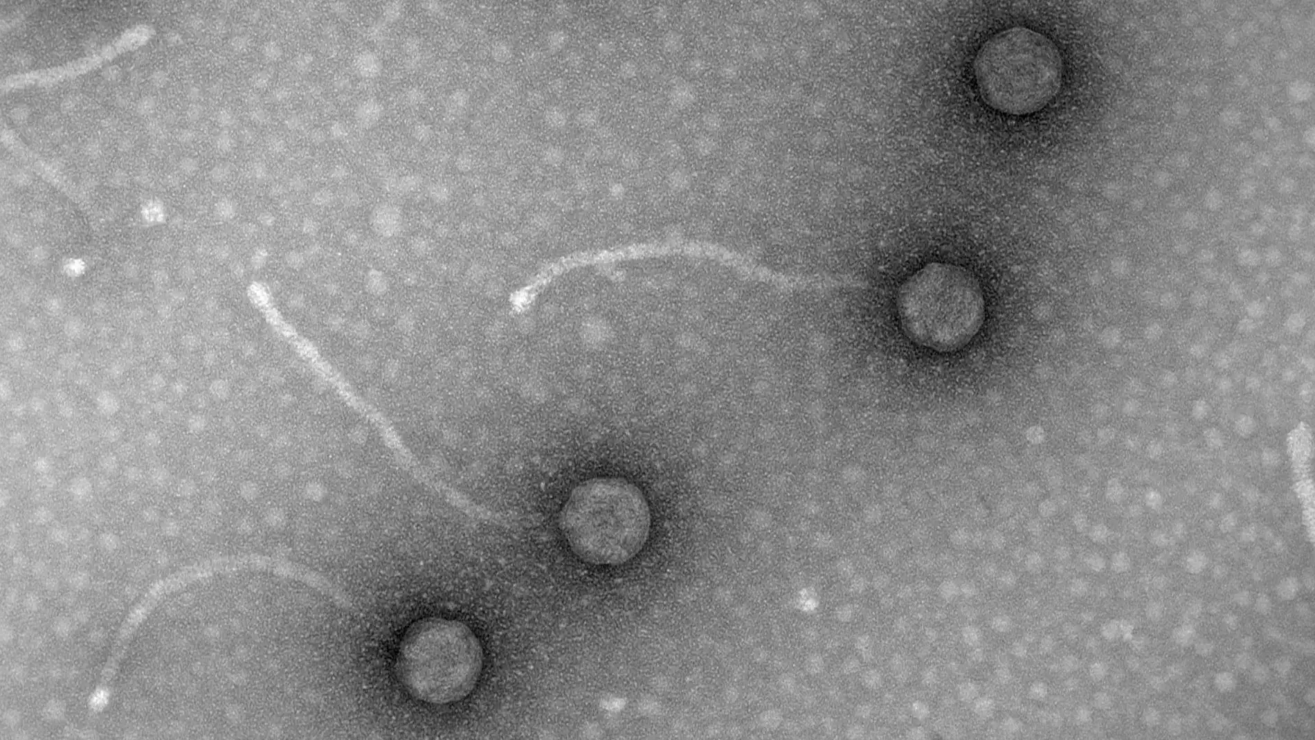 Fagos, los virus &quot;come&quot; bacterias para combatir la resistencia a los antibióticos