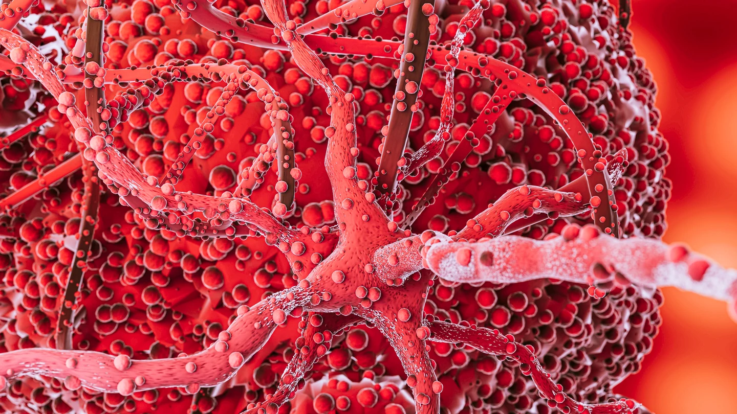 Esta es la nueva 'revolución' para tratar el mieloma múltiple, un tipo de cáncer de la médula ósea Esta es la nueva 'revolución' para tratar el mieloma múltiple, un tipo de cáncer de la médula ósea