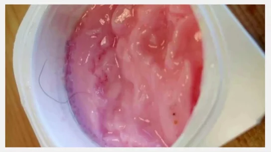Yogures con pelos, fruta podrida y cubiertos con "mierda": un universitario denuncia ante Chicote la comida de su residencia Yogures con pelos, fruta podrida y cubiertos con "mierda": un universitario denuncia ante Chicote la comida de su residencia