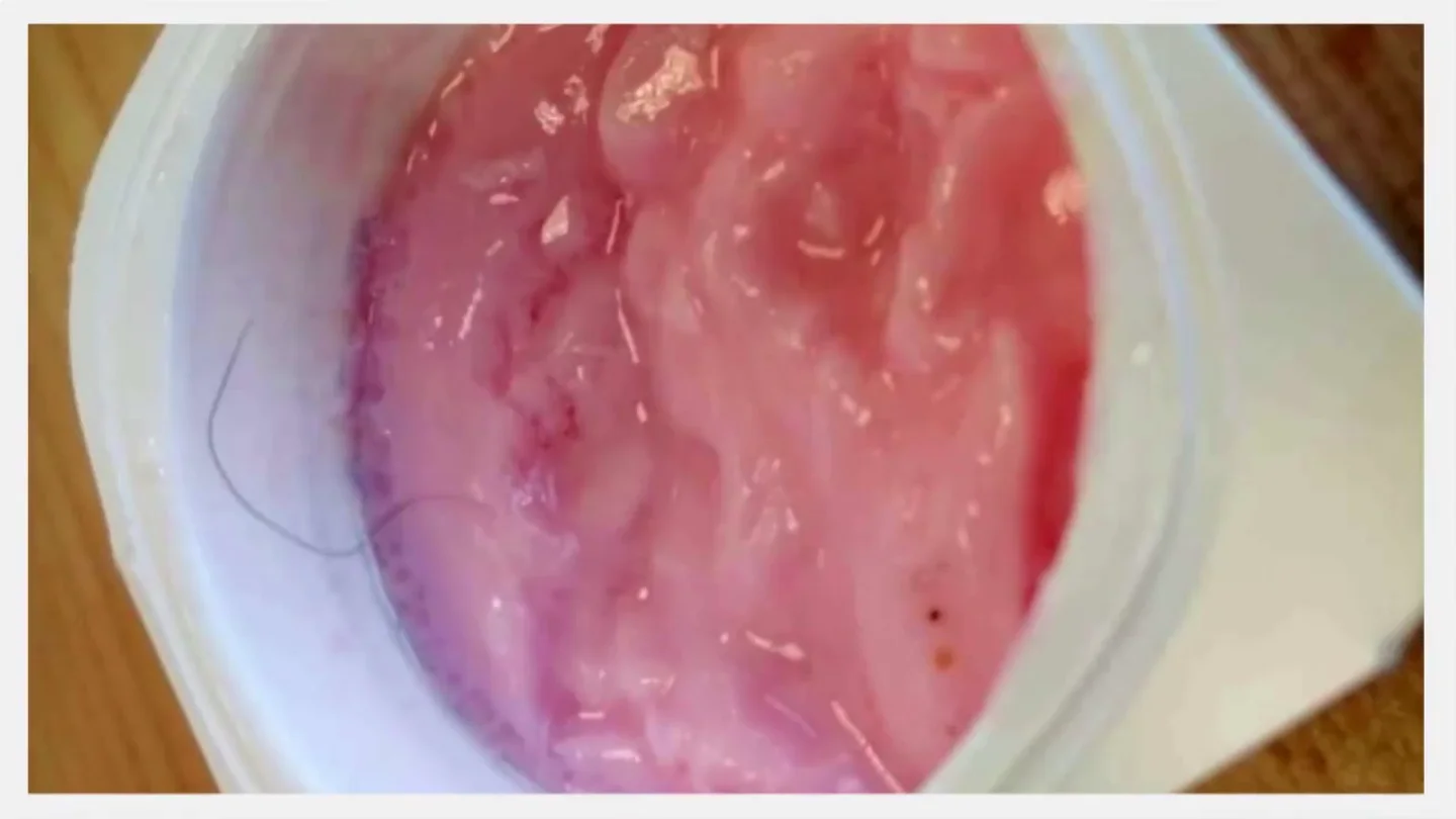 Yogures con pelos, fruta podrida y cubiertos con "mierda": un universitario denuncia ante Chicote la comida de su residencia Yogures con pelos, fruta podrida y cubiertos con "mierda": un universitario denuncia ante Chicote la comida de su residencia
