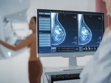 El cáncer de mama es uno de los que presenta mayor incidencia entre la población menor de 50 años El cáncer de mama es uno de los que presenta mayor incidencia entre la población menor de 50 años