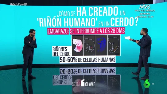 Un equipo de científicos logra desarrollar el primer órgano humano dentro de un animal Un equipo de científicos logra desarrollar el primer órgano humano dentro de un animal