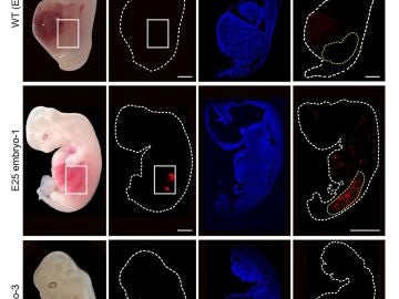 Cultivan por primera vez riñones humanos en embriones de cerdo de hasta 28 días